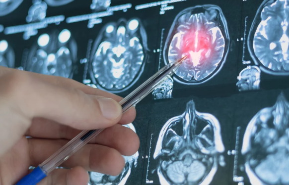 Chinaanse AI-onderzoeken kunnen depressierisico voorspellen vóórdat symptomen verschijnen